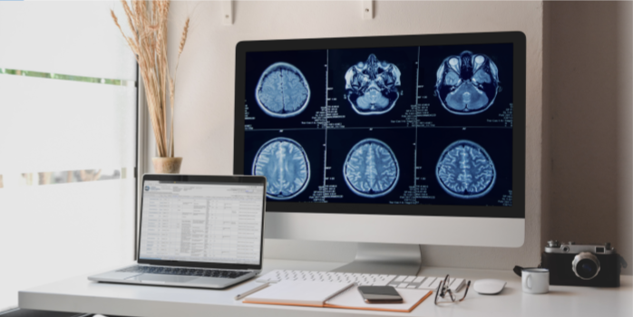 How teleradiology has made all the difference in my work and life